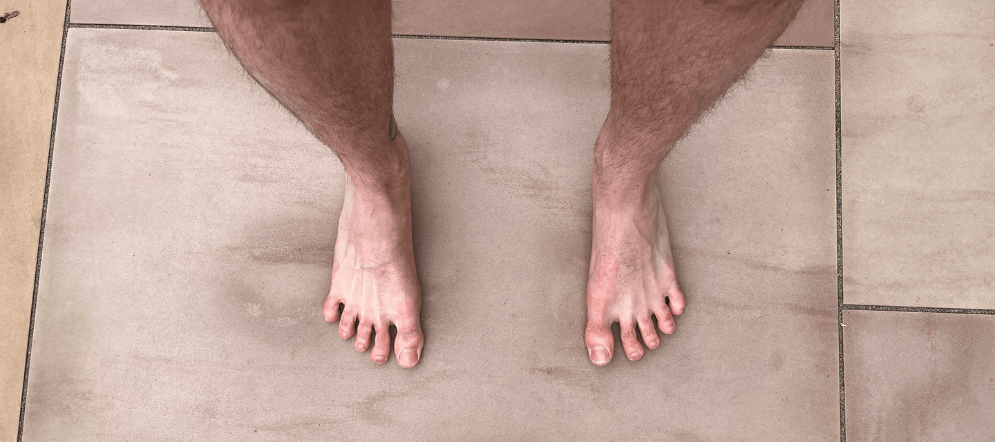 Can Your Toes Do This? Five Signs Your Feet Need More Space