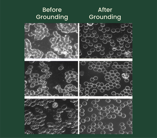 Before and after images showing the effects of grounding on blood viscosity (zeta potential)