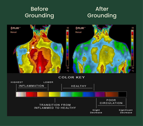 Before and after diagram showing the effects of grounding on inflammation