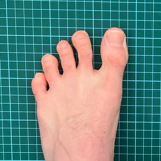 Splayed toes