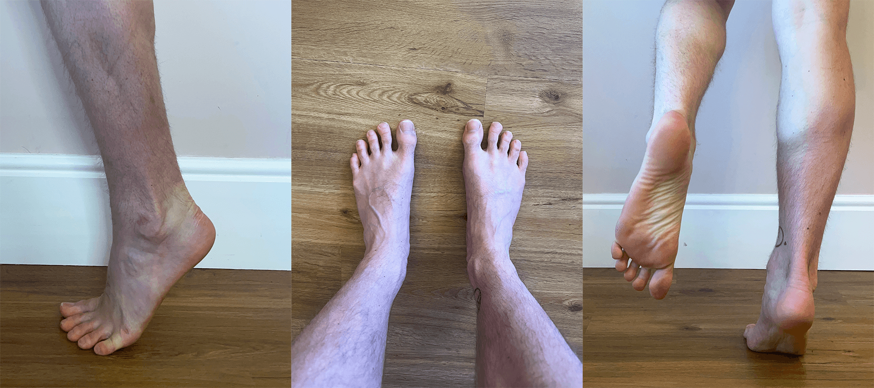 Foot Core Explanation 