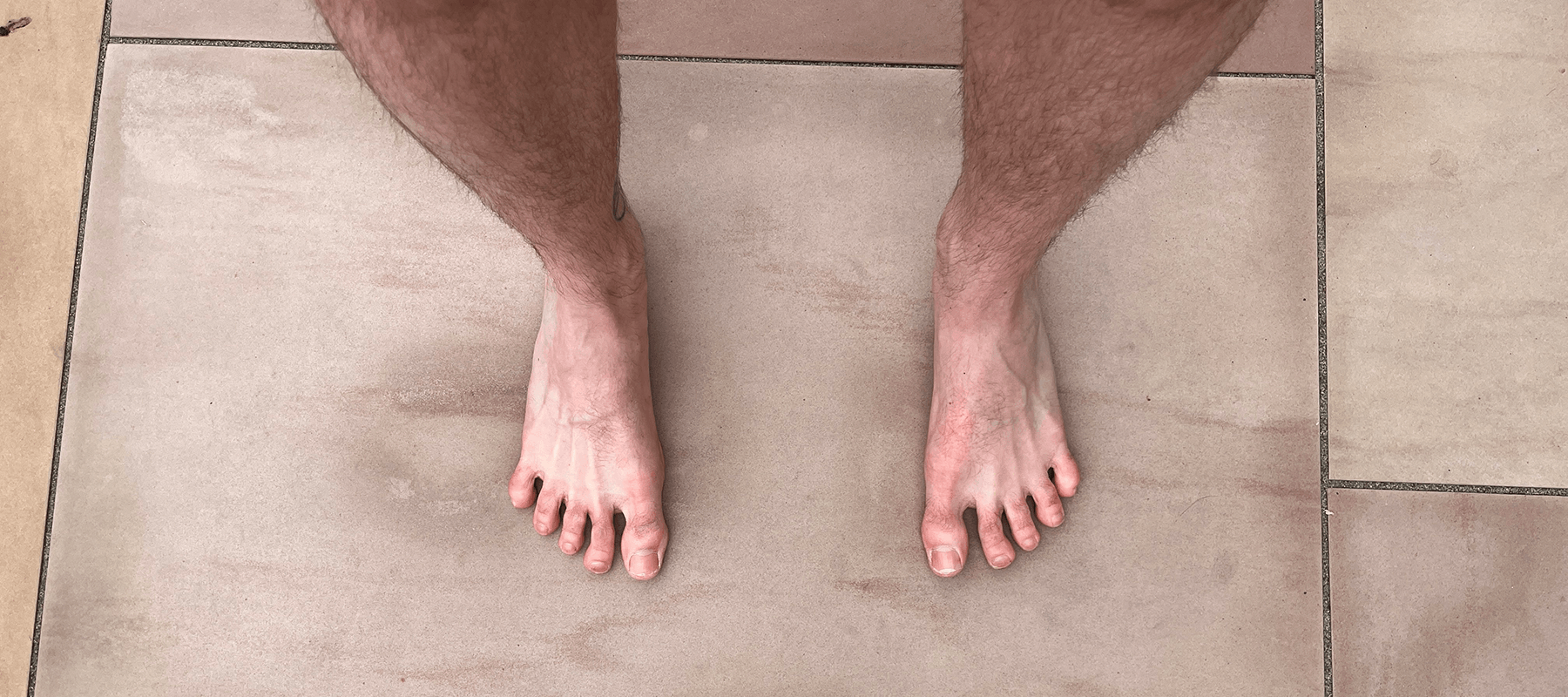 Image of feet showing toe splay