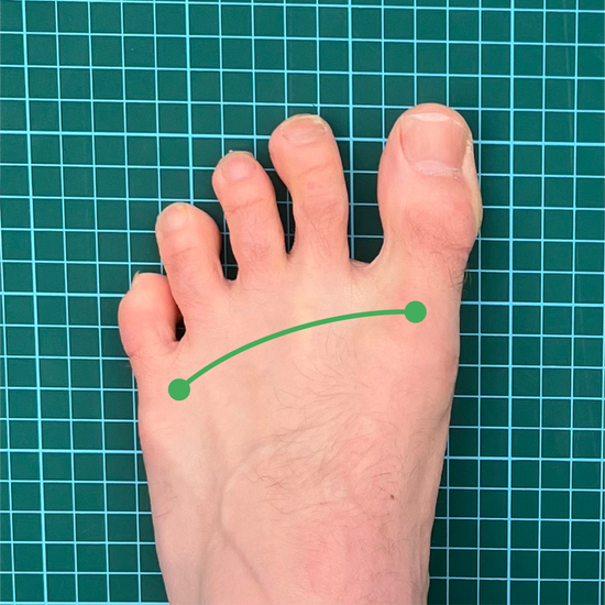 Broad foot